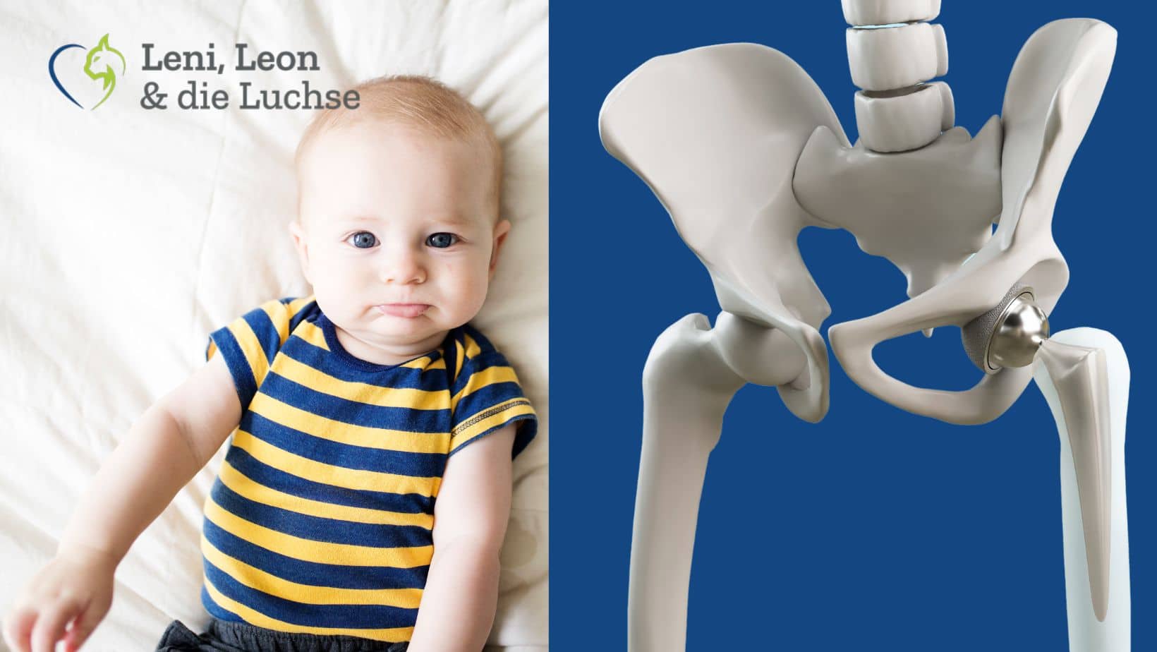 Hüftdysplasie bei Babys Was Sie wissen müssen Leni, Leon & die Luchse