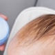 Kopf eines Babys und einer Creme zur Vorbeugung von Kopfgneiss