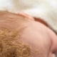 Milchschorf auf Kopf von Baby