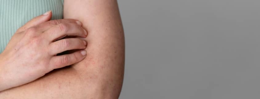 Neurodermitis beim Kind: Der ehrliche Guide zu PKV, Gesundheitsprüfung & Versicherungsschutz 1