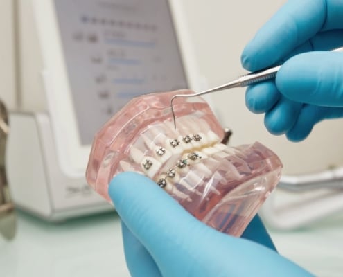 Kostenfalle Zahnspange: Der komplette Guide zu Kosten, KIG & Versicherungsschutz für dein Kind 3